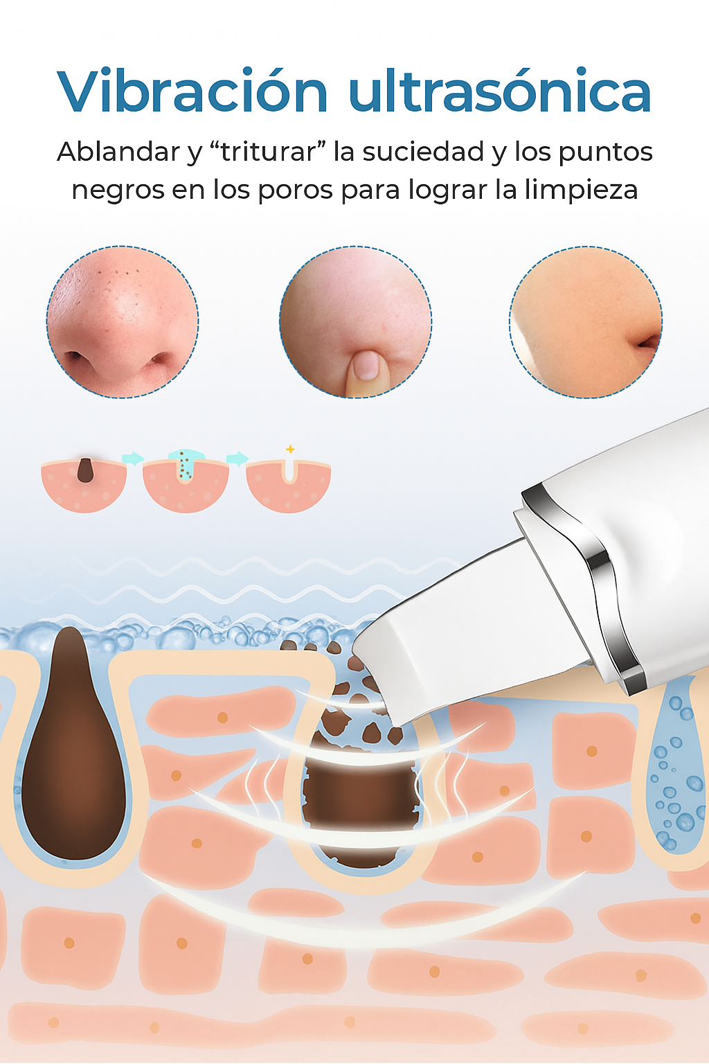 Limpiador Facial Peeling Ultrasónico COMPRA 2 POR EL PRECIO DE 1 SUPER OFERTA
